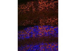 Immunofluorescence analysis of rat brain using Aquaporin-4 (Aquaporin-4 ) Rabbit mAb (ABIN7265653) at dilution of 1:100 (40x lens). (Aquaporin 4 Antikörper)