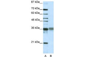WB Suggested Anti-TLX2 Antibody Titration:  2.