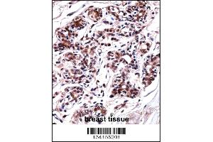 UBP1 Antibody immunohistochemistry analysis in formalin fixed and paraffin embedded human breast tissue followed by peroxidase conjugation of the secondary antibody and DAB staining. (UBP1 Antikörper  (AA 266-295))