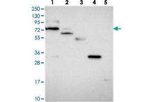 Western blot analysis of Lane 1: RT-4, Lane 2: U-251 MG, Lane 3: Human Plasma, Lane 4: Liver, Lane 5: Tonsil with ARHGAP44 polyclonal antibody .