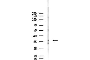 Western blot analysis of lysates from HepG2 cells(starvation,24h treatment), using MTHF Antibody at 1/1000 dilution.