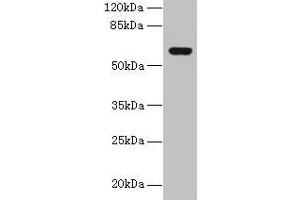 Western blot All lanes: KATNAL2 antibody at 1 μg/mL + U251 whole cell lysate Secondary Goat polyclonal to rabbit IgG at 1/10000 dilution Predicted band size: 62, 53 kDa Observed band size: 62 kDa (KATNAL2 Antikörper  (AA 18-307))