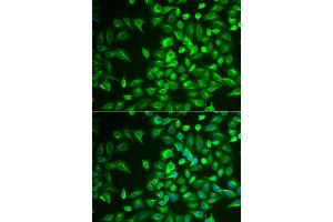 Immunofluorescence analysis of U2OS cells using LRAT antibody (ABIN6132019, ABIN6143313, ABIN6143316 and ABIN6222345). (LRAT Antikörper  (AA 1-194))