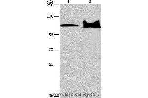 Western blot analysis of Mouse heart and brain tissue, using KDM4C Polyclonal Antibody at dilution of 1:800