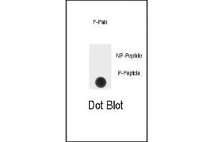 Dot Blot (DB) image for anti-Sprouty RTK Signaling Antagonist 4 (SPRY4) (pTyr75) antibody (ABIN389968)
