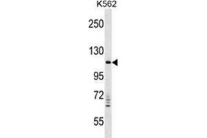 VPS11 Antibody (C-term) western blot analysis in K562 cell line lysates (35 µg/lane). (VPS11 Antikörper  (C-Term))
