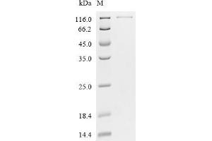 (Tris-Glycine gel) Discontinuous SDS-PAGE (reduced) with 5 % enrichment gel and 15 % separation gel.