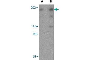 Western blot analysis of RTN4 in human brain tissue lysate with RTN4 polyclonal antibody  at (A) 0. (Reticulon 4 Antikörper  (Internal Region))