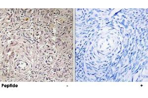 Immunohistochemistry analysis of paraffin-embedded human ovary tissue using GCNT7 polyclonal antibody . (GCNT7 Antikörper)