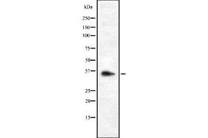Western blot analysis OR9G1 using K562 whole cell lysates (OR9G1 Antikörper  (Internal Region))