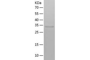 PBX4 Protein (AA 121-374) (His tag)