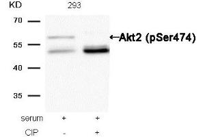 Western blot analysis of extracts from 293 cells, treated with serum or calf intestinal phosphatase (CIP), using Akt2 (Phospho-Ser474) Antibody. (AKT2 Antikörper  (pSer474))
