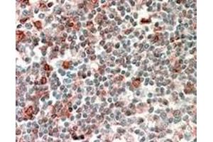 Image no. 3 for anti-Neutrophil Cytosolic Factor 4, 40kDa (NCF4) (Internal Region) antibody (ABIN374770) (NCF4 Antikörper  (Internal Region))