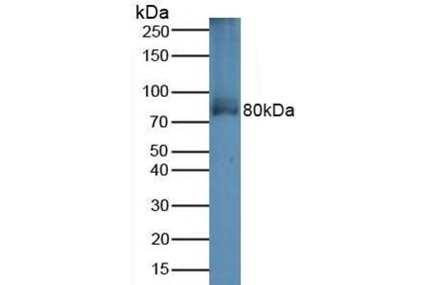 Transferrin Receptor 2 Antikörper  (AA 4-87)