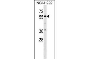 Western blot analysis in NCI-H292 cell line lysates (35ug/lane). (ZNF512 Antikörper  (N-Term))