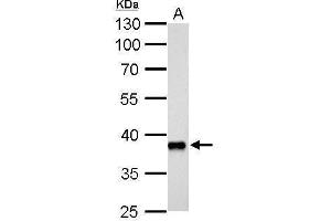 AKR1C3 Antikörper  (C-Term)