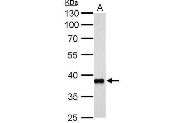 AKR1C3 Antikörper  (C-Term)