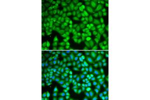 Immunofluorescence analysis of U2OS cells using WAS antibody (ABIN5970366). (WASP Antikörper)