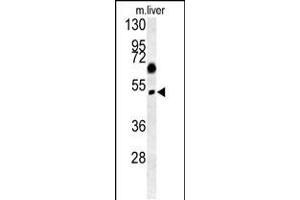 Western blot analysis in mouse liver tissue lysates (15ug/lane). (SNX31 Antikörper  (N-Term))