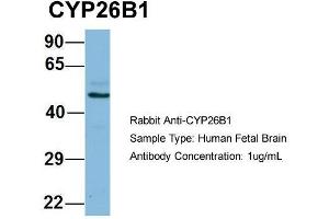 Host: Rabbit  Target Name: CYP26B1  Sample Tissue: Human Fetal Brain  Antibody Dilution: 1.