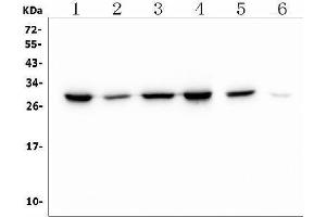 Western blot analysis of PRDX6 using anti-PRDX6 antibody (ABIN7600102).