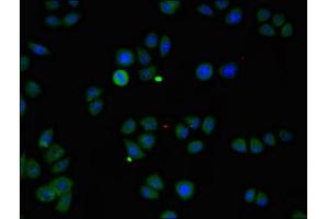 Immunofluorescent analysis of PC-3 cells using ABIN7146178 at dilution of 1:100 and Alexa Fluor 488-congugated AffiniPure Goat Anti-Rabbit IgG(H+L) (ZMPSTE24 Antikörper  (AA 217-347))