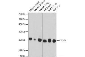 Western blot analysis of extracts of various cell lines using VEGF Monoclonal Antibody at dilution of 1:500. (VEGF Antikörper)