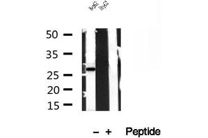 Western blot analysis of extracts of HepG2 cells, using TPI1 antibody. (TPI1 Antikörper  (C-Term))