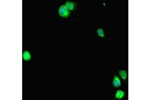 Immunofluorescent analysis of Hela cells using ABIN7169671 at dilution of 1:100 and Alexa Fluor 488-congugated AffiniPure Goat Anti-Rabbit IgG(H+L) (STAT2 Antikörper  (AA 571-851))