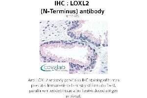 Image no. 2 for anti-Lysyl Oxidase-Like 2 (LOXL2) (N-Term) antibody (ABIN1736517) (LOXL2 Antikörper  (N-Term))