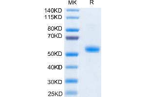 Biotinylated Human CD40L on Tris-Bis PAGE under reduced condition. (CD40 Ligand Protein (CD40LG) (Trimer) (His-DYKDDDDK Tag,Biotin))