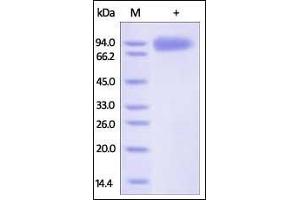 HIV-1 [HIV-1/Clade E (CM244)] GP120 on SDS-PAGE under reducing (R) condition. (Human Immunodeficiency Virus Surface Glycoprotein (HIV gp120) (AA 36-511) protein (His tag))
