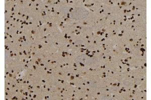 ABIN6279896 at 1/100 staining Rat brain tissue by IHC-P. (USP29 Antikörper)