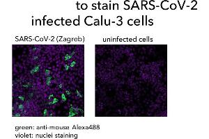 Calu-3 cells were infected with SARS-CoV-2, fixed with formaldehyde and stained with (ABIN7581774) followed by anti-mouse-Alexa488 staining and a nuclear marker. (Rekombinanter SARS-CoV-2 Nucleocapsid Antikörper  (Whole Molecule))