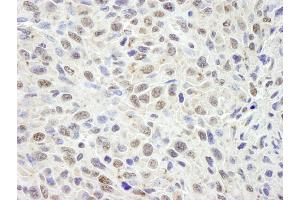 Immunohistochemistry (IHC) image for anti-Cell Division Cycle and Apoptosis Regulator 1 (CCAR1) (AA 1-50) antibody (ABIN7448463) (CCAR1 Antikörper  (AA 1-50))