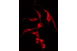 Immunofluorescence (fixed cells) (IF/ICC) image for anti-Cadherin 9 (CDH9) (Internal Region) antibody (ABIN6257693)