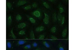 Immunofluorescence analysis of U-2 OS cells using SIGLEC9 Polyclonal Antibody at dilution of 1:100 (40x lens). (SIGLEC9 Antikörper)