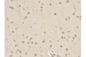 Immunohistochemistry (IHC) image for anti-Autophagy related 4A Cysteine Peptidase (ATG4A) antibody (ABIN1871138) (ATG4A Antikörper)