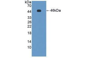 Figure. (PFKM Antikörper  (AA 2-390))