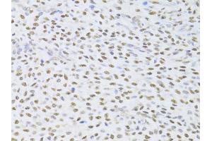 Immunohistochemistry of paraffin-embedded human adenomyosis using FKBP4 Antibody (ABIN5973289) at dilution of 1/100 (40x lens). (FKBP4 Antikörper)
