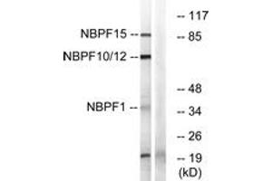 Western blot analysis of extracts from 293/HepG2/Jurkat/COLO cells, using NBPF1/9/10/12/14/15/16/20 Antibody. (NBPF1,9,10,12,14,15,16,20 (AA 121-150) Antikörper)