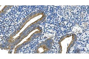IHC analysis of DRP1/DNM1L using anti-DRP1/DNM1L antibody (ABIN7602180). (Dynamin 1-Like Antikörper  (AA 618-736))
