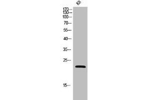 NCR3 Antikörper  (Extracellular Domain, Transmembrane Domain)