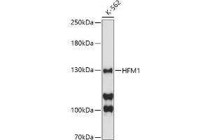 Western blot analysis of extracts of K-562 cells, using HFM1 antibody (ABIN6133318, ABIN6141741, ABIN6141743 and ABIN6224711) at 1:500 dilution. (HFM1 Antikörper  (AA 1-240))