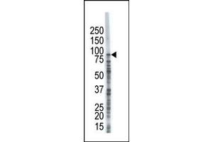 Image no. 1 for anti-Ubiquitin Specific Peptidase 8 (USP8) (C-Term) antibody (ABIN357537) (USP8 Antikörper  (C-Term))