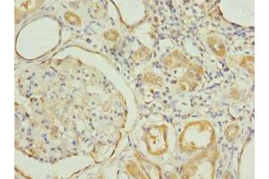 Immunohistochemistry of paraffin-embedded human kidney tissue using ABIN7151188 at dilution of 1:100 (RNF31 Antikörper  (AA 421-700))