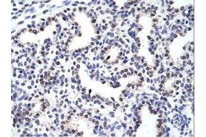 Image no. 1 for anti-Wingless-Type MMTV Integration Site Family, Member 2B (WNT2B) (AA 229-278) antibody (ABIN203089)