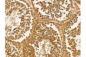 ABIN6262098 and ABIN6269010 at 1/100 staining Rat testis tissue by IHC-P. (HSPA9 Antikörper  (C-Term))