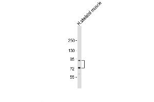 Western Blot at 1:2000 dilution + human skeletal muscle lysate Lysates/proteins at 20 ug per lane. (LTK Antikörper  (N-Term))