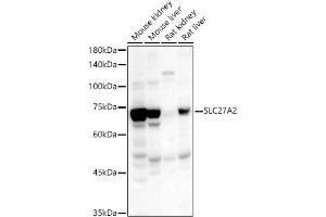 Western blot analysis of extracts of various cell lines, using SLC27 antibody (ABIN3021377, ABIN3021378, ABIN1513532 and ABIN6214970) at 1:567 dilution. (SLC27A2 Antikörper  (AA 30-200))